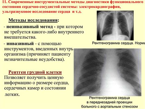 Современные методы сосудистой диагностики