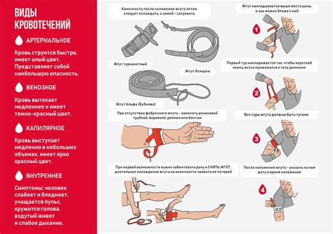 Создание жгута для облегчения хвата