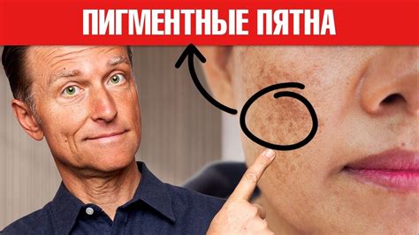 Способы борьбы со шипицами на руках