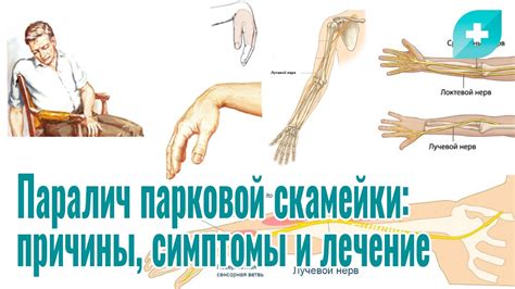 Способы диагностики паралича