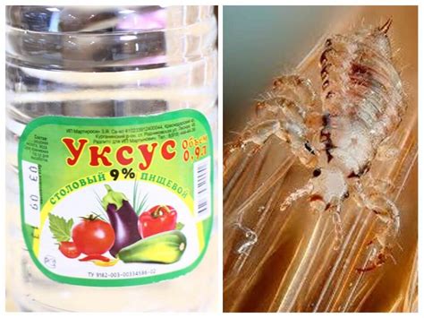 Способы избавления от вшей уксусом