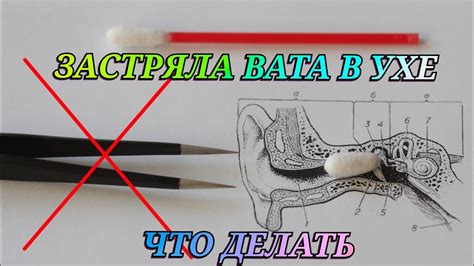 Способы помощи при прижатых ушах