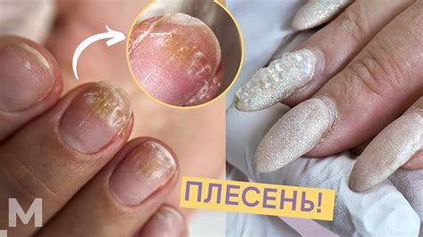 Способы предотвращения отслойки геля на ногтях