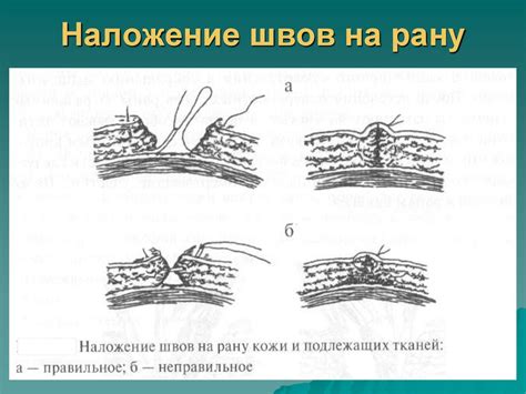 Способы предотвращения расхождения швов