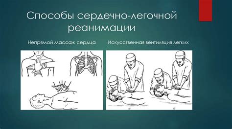 Способы реанимации