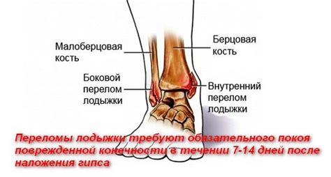 Сроки восстановления после перелома мизинца