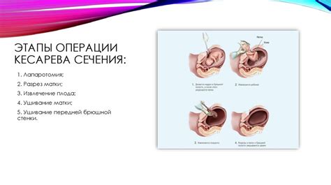 Сроки ослабления послеоперационной слабости после кесарева сечения