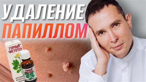Стоит ли решаться на эпиляцию для удаления усов