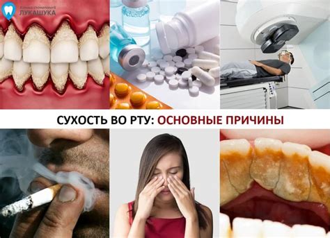 Сухость во рту и нарушение процесса пищеварения