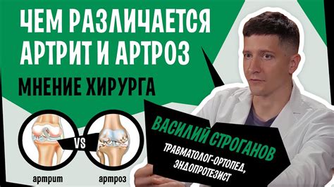 Сыворотка и артрит: экспертное мнение