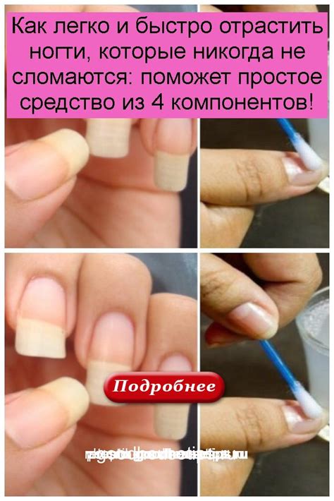 Тайны быстрого роста ногтей