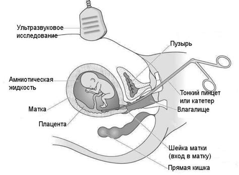 Техника проведения