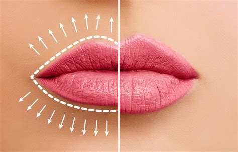 Техники ухода за губами для естественного увеличения