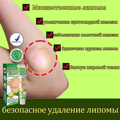 Типы грева при воспалении лимфоузлов