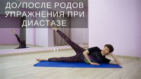Тренировка пресса при диастазе: основные принципы