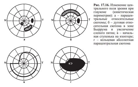 Увеличение поля зрения