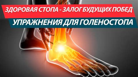 Укрепление стопы