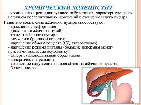 Уменьшение интенсивности симптомов хронического холецистита