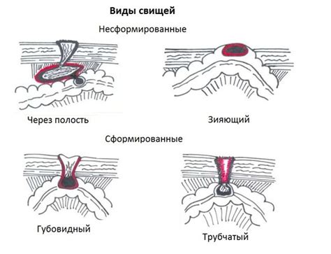 Ускорение процесса заживления после снятия швов