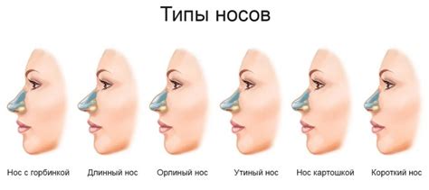 Уточнение формы горбатого носа