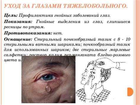 Уход за глазами: гигиена и профилактика заболеваний