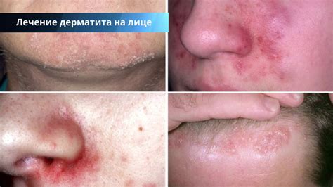 Ушиб на лице: причины и симптомы