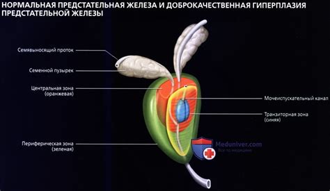 Факторы, способствующие увеличению объема предстательной железы