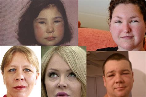 Факт третий: бледность кожи может быть симптомом серьезных заболеваний