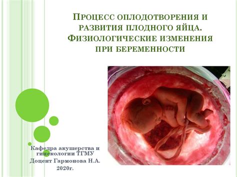 Физиологические изменения при беременности с близнецами