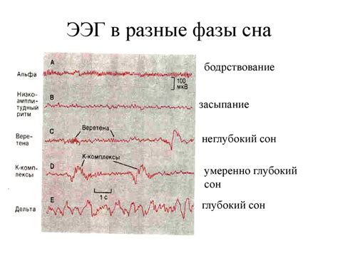 Физиологические причины собачьих судорог во время сна