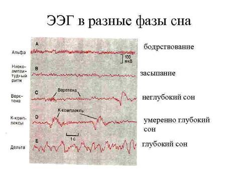 Физиологическое объяснение механизма сна