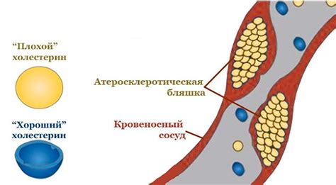 Физическая активность и альфа-липопротеины: взаимосвязь
