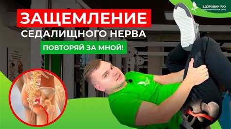 Физическая терапия при седалищной невралгии