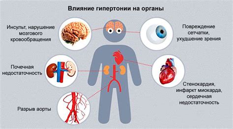 Физические проявления гипертонии