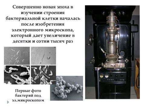 Фиксация бактериальной клетки для электронного микроскопа