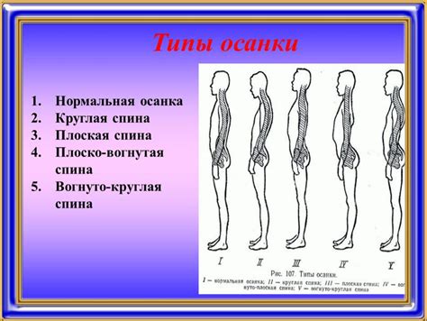 Формирование правильного положения позвоночника