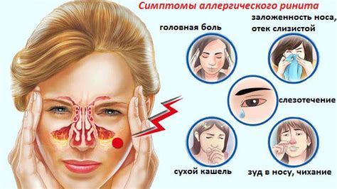 Хронический насморк и проблемы со слизью