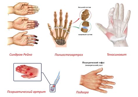 Чесание пальцев на руках: причины