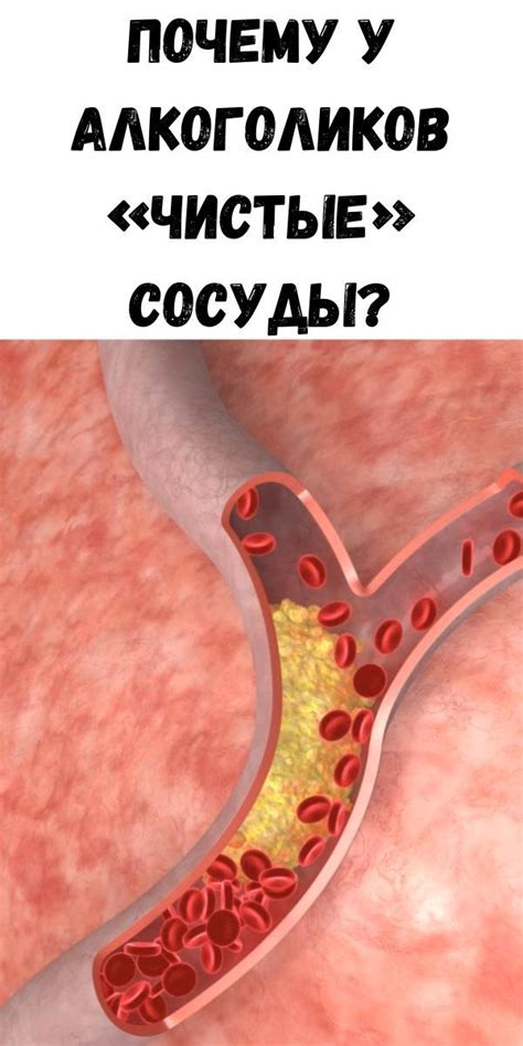 Чистые сосуды у абстинентов: причина и влияние
