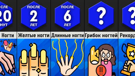 Что делать, если не удается самостоятельно стричь ногти котятам