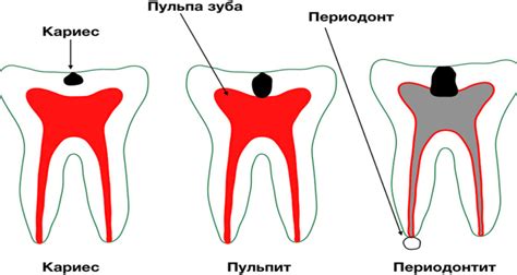 Что такое пожалование