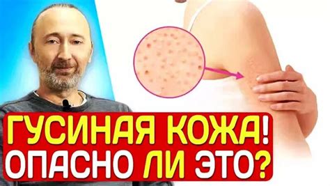 Что такое пупырышки на коже рук