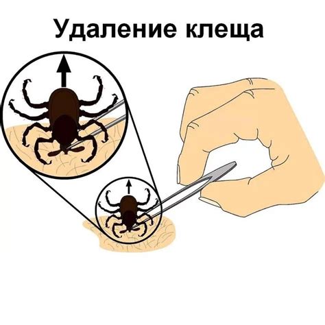 Шаги по удалению клеща с собаки пинцетом