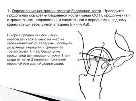 Шаг 1: Определение точки надлобковой впадины