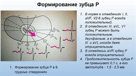 Шаг 2: Формирование зубцов