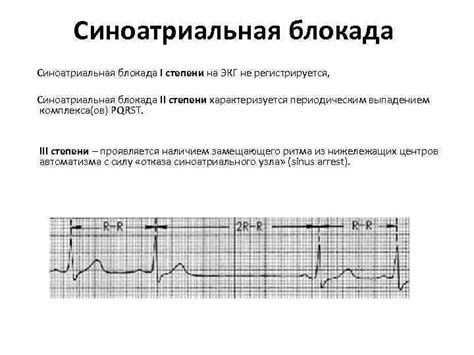 Шаг 4: Запись ЭКГ