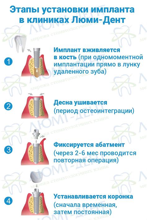 Шаг 5: Выделение рта и зубов