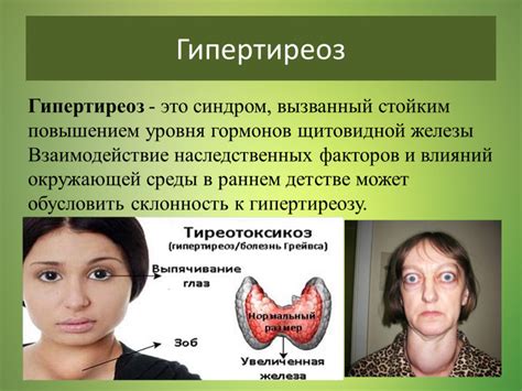 Щитовидная железа: причины давления и симптомы