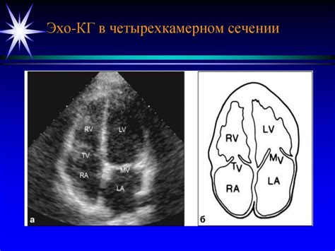 ЭХО-КГ: последние достижения в исследовании сердечно-сосудистой системы