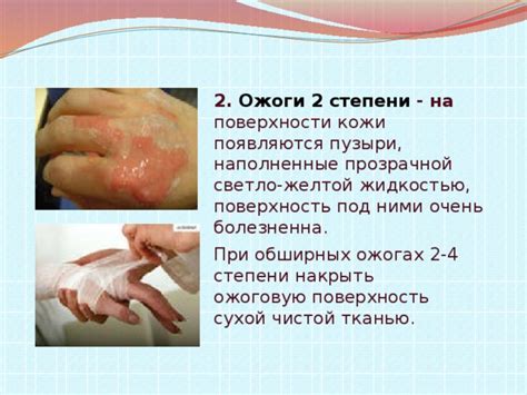 Экстренные меры при обширных ожогах